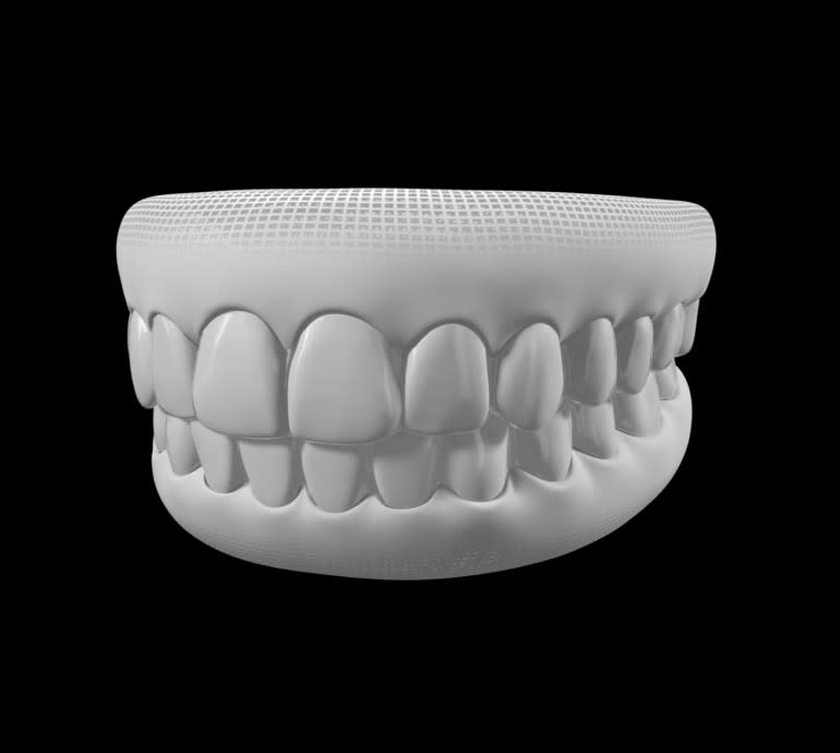 Treatable Cases > Carousel > Generally straighter teeth > Image