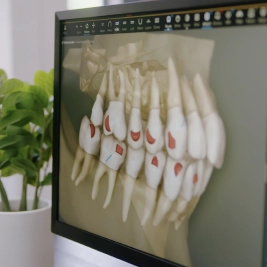 image-card-teeth-attachments