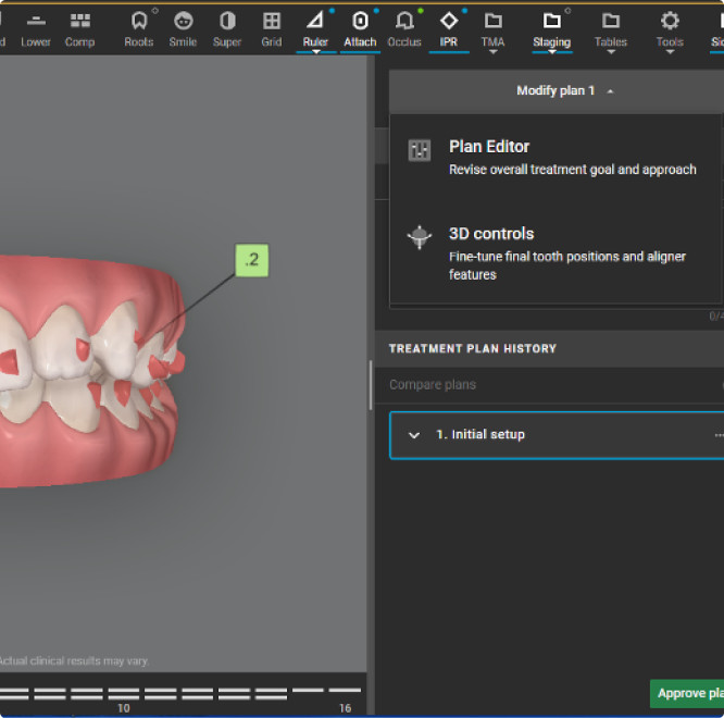 ClinCheck Pro Software view