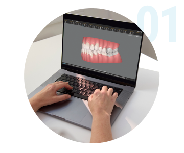 image-icon-laptop-with-teeth-on-screen