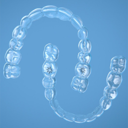 image-accordion-clear-aligners