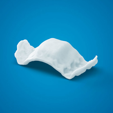 Invisalign® Palatal Expander | Invisalign.com