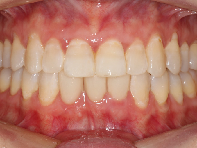 after image