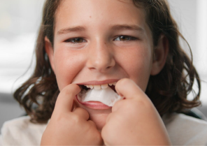 image-card-palatal-expander