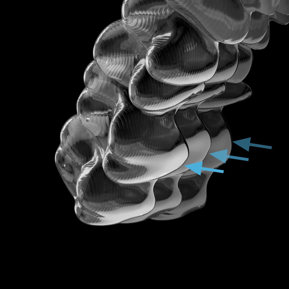 With proprietary innovations, like SmartTrack material, SmartForce features and SmartStage technology, perhaps it’s no surprise that Invisalign treatment is the most advanced clear aligner system.