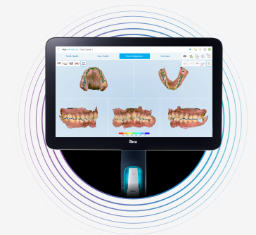 bite-alignment-monitor-image