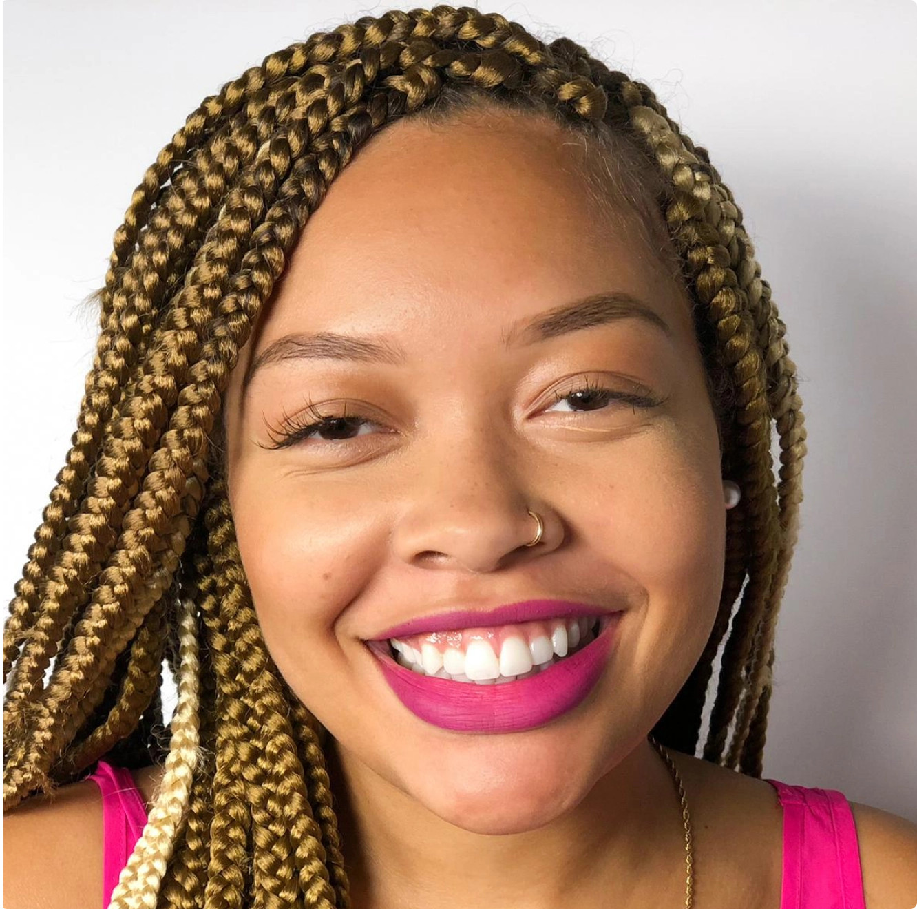 Black woman's smile before her Invisalign® treatment