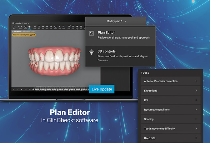 Treatment planning view on ClinCheck Pro software