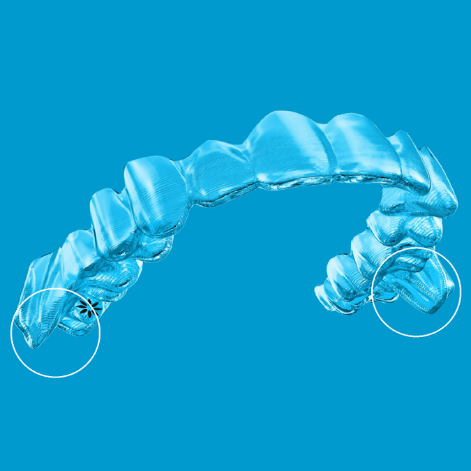 Allineatori Invisalign® con ali di precisione