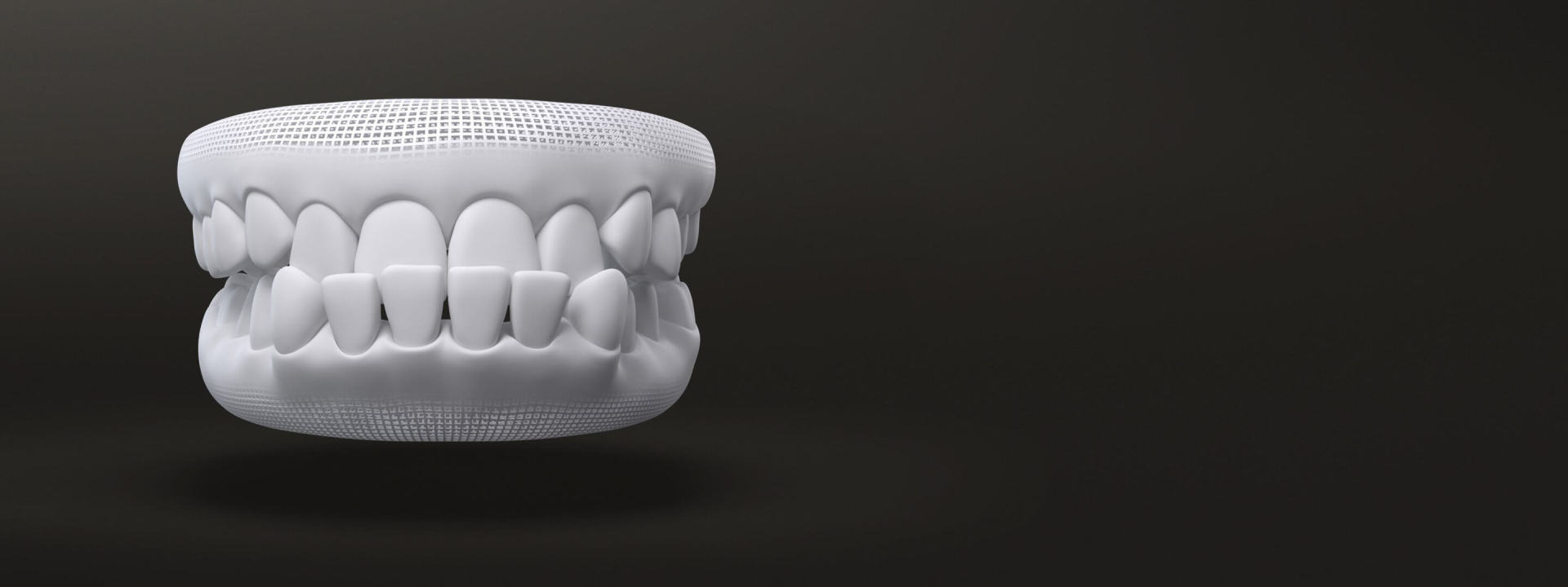 Morso inverso modello 3D - Allineatori dentali trasparenti - Invisalign Italia