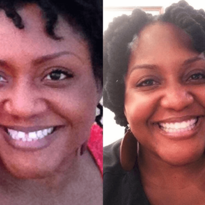 smile invisible aligners