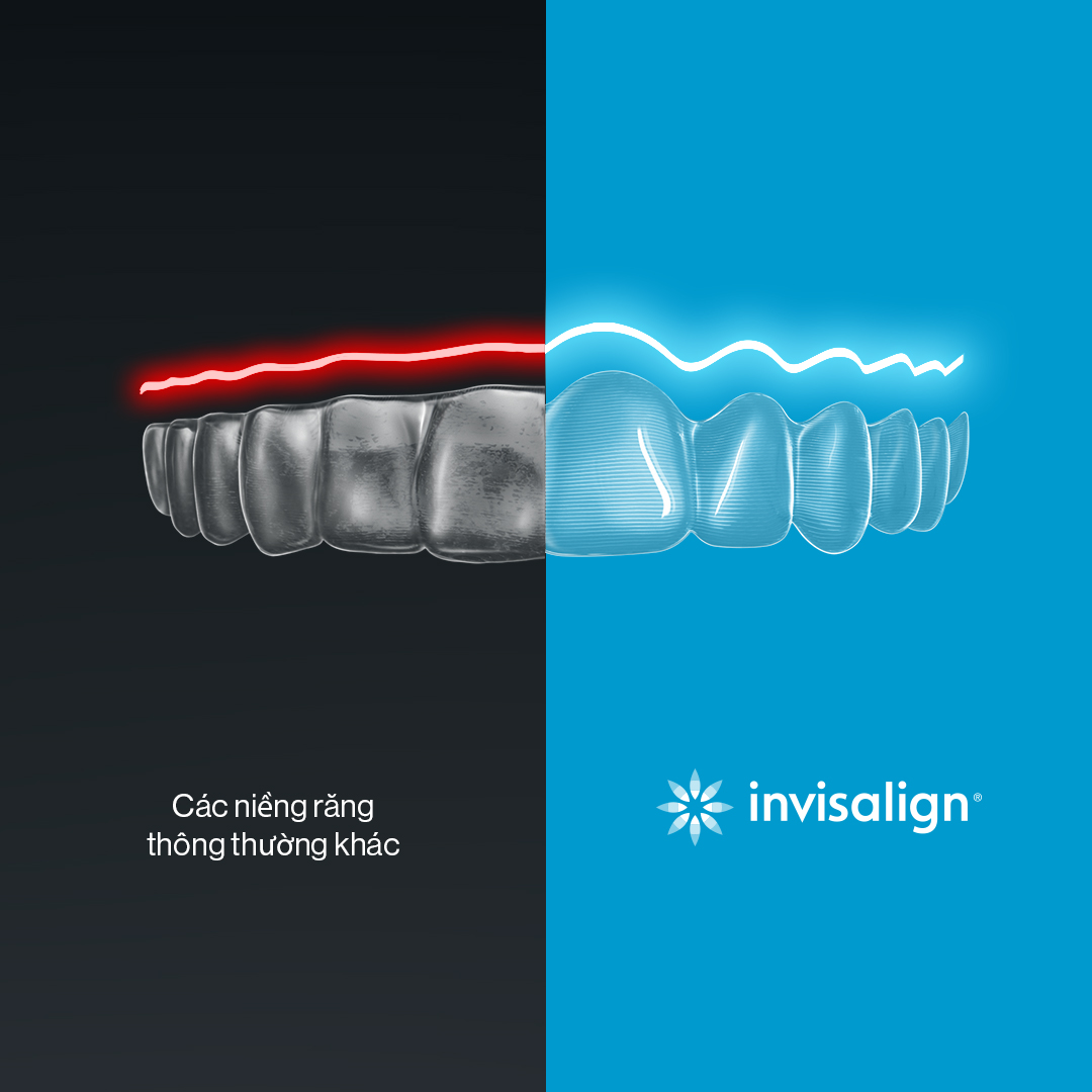 Invisalign Stock Photos and Images - 123RF