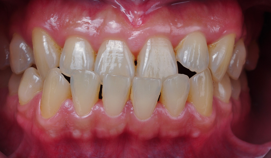 before image