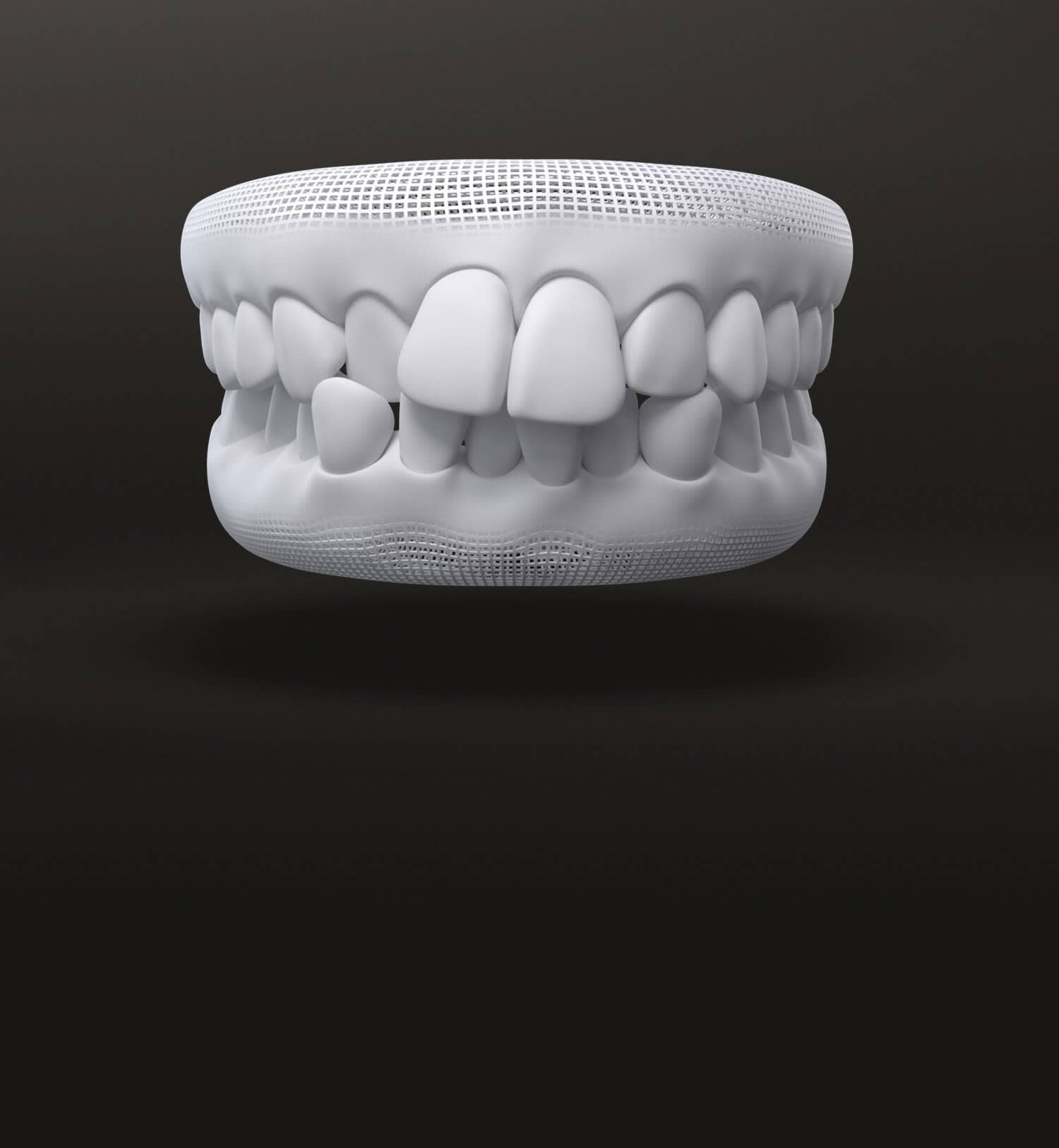 Crowded teeth model 3d - Invisalign treatments UK