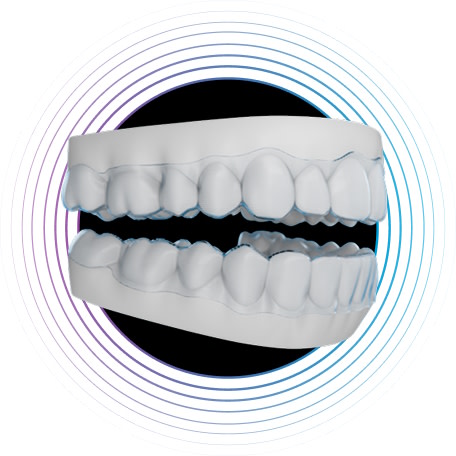 Innovation | Treat | Extended trimline