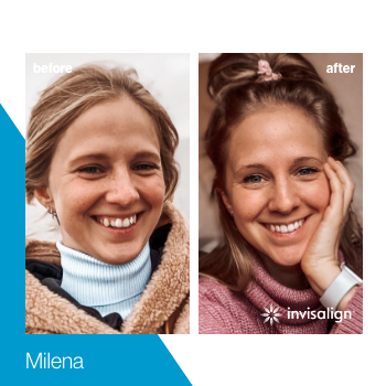 Invisalign Before and After Stories With Our Patients - Gorman