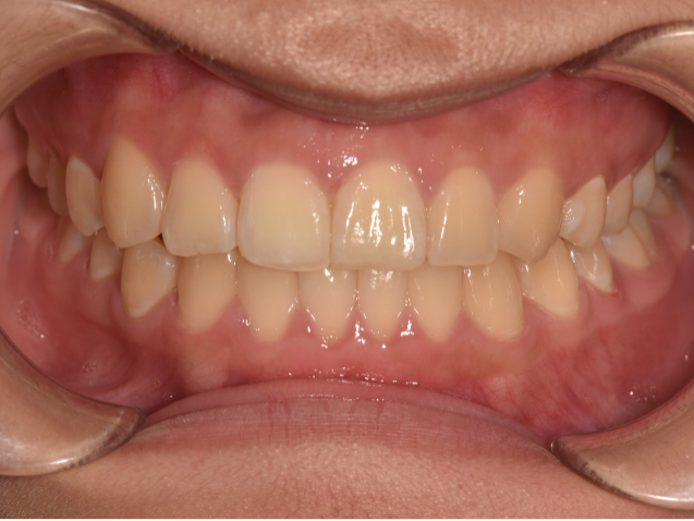 after image