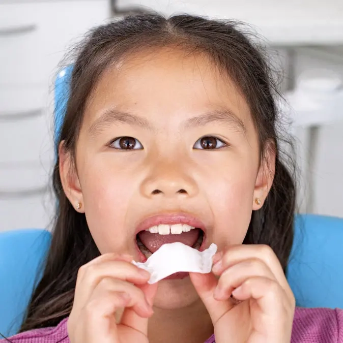 Little girl wearing Invisalign palatal expander