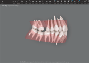 Roots and gingiva