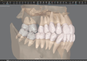 Roots with semitransparent view on CBCT integration