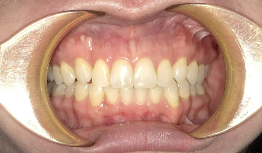 after image