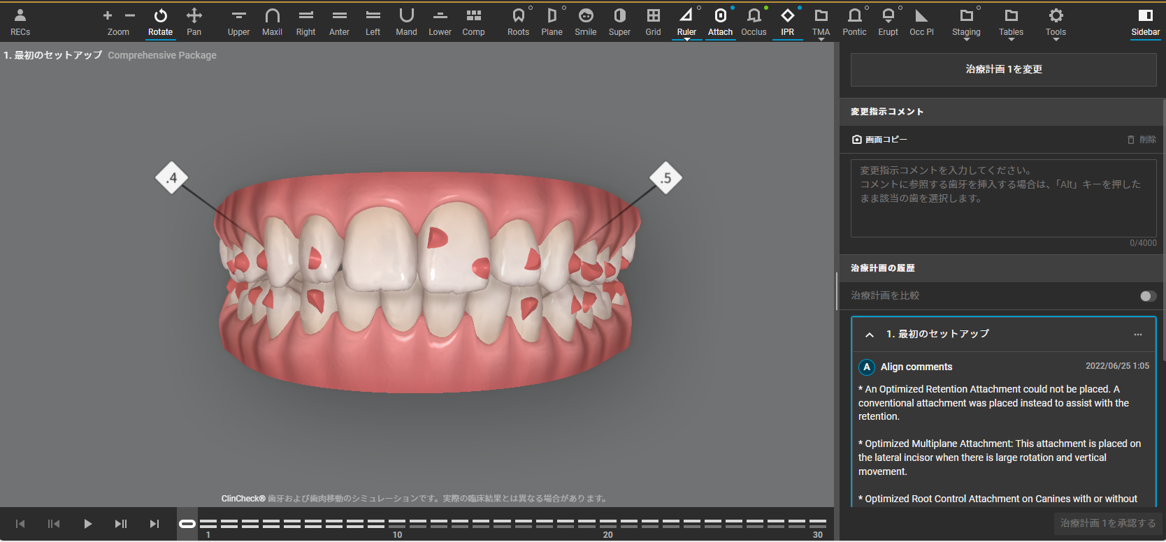 ClinCheck Pro ソフトウェア