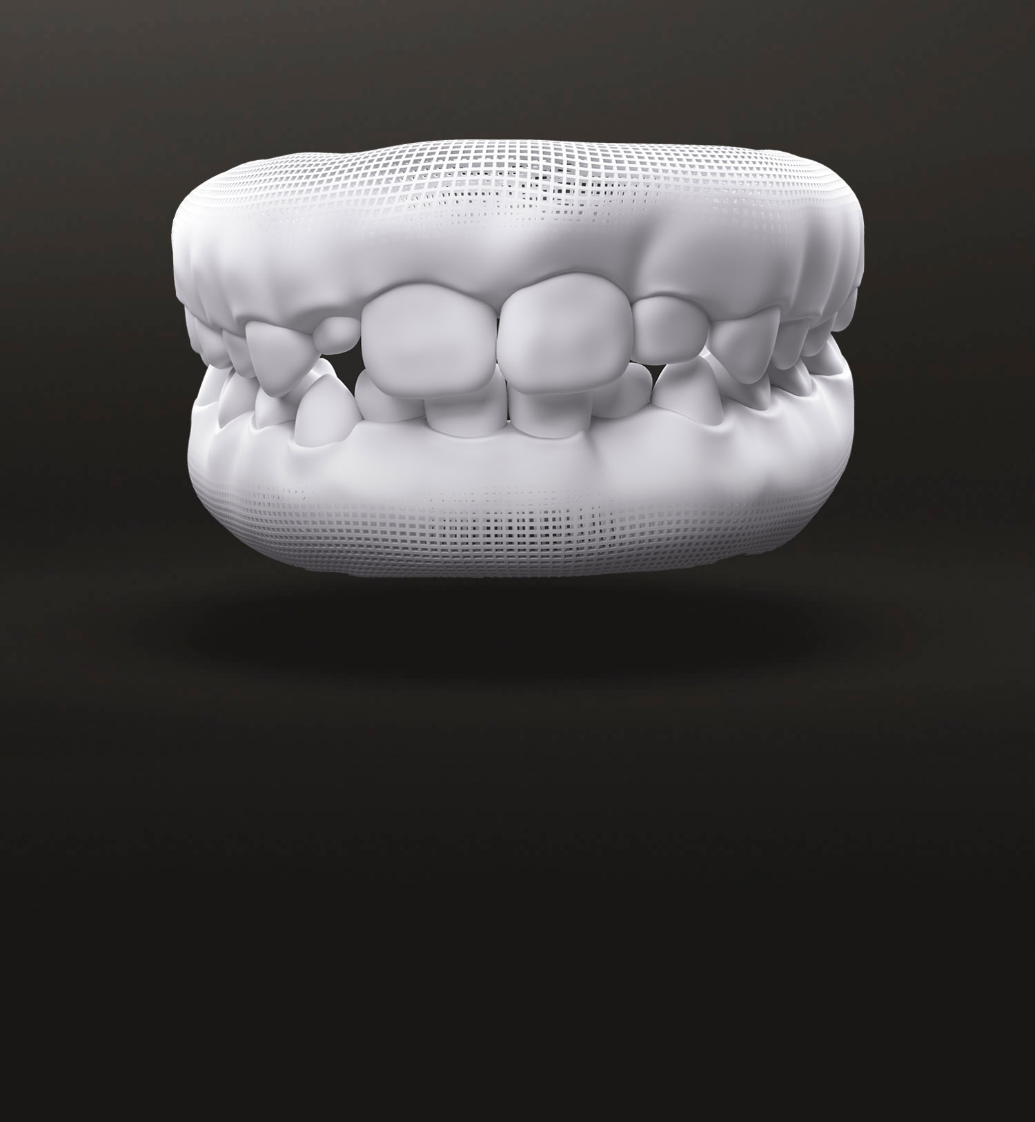 Invisalign Treatable Cases