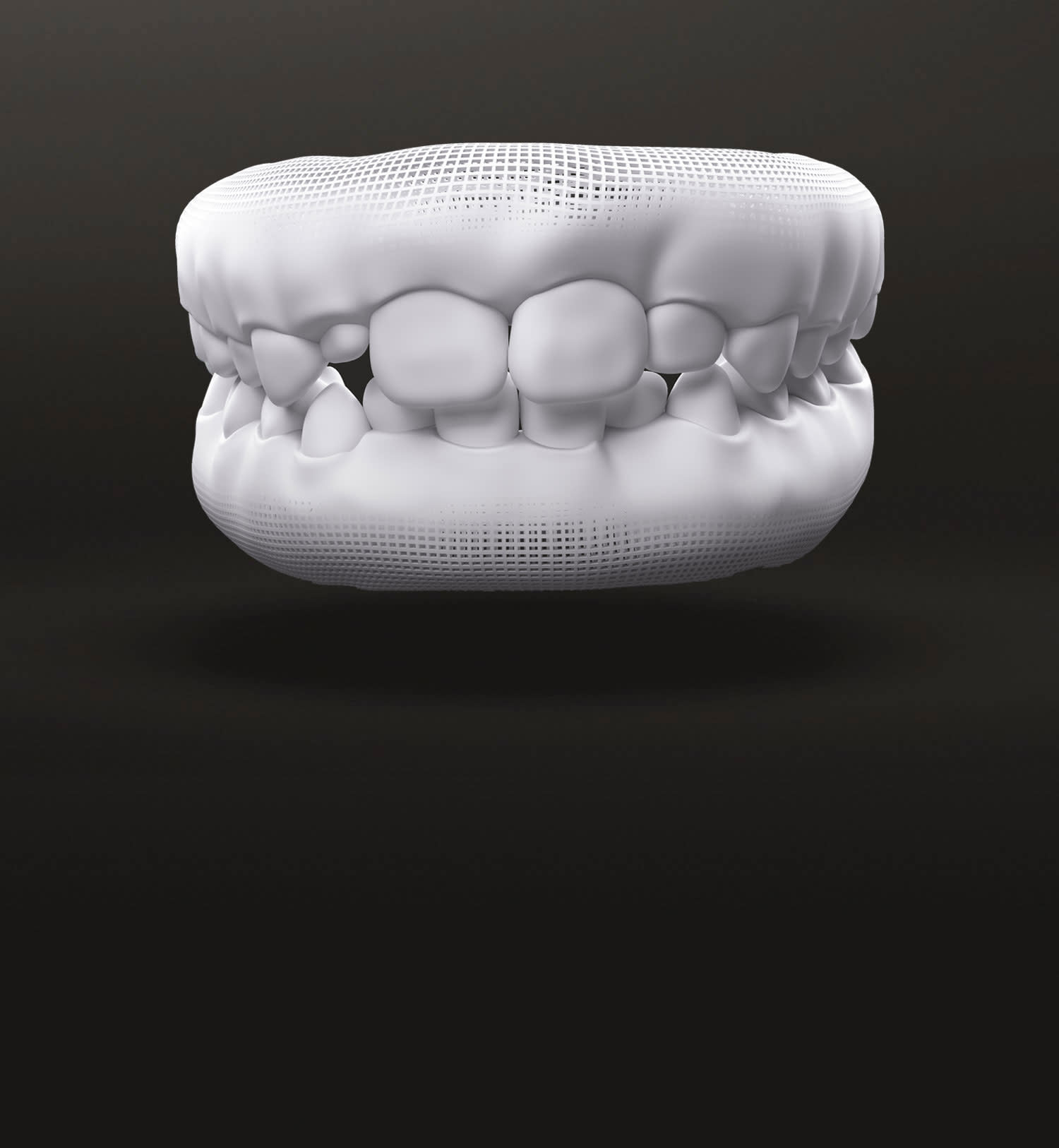 Dentizione mista con denti da latte e permanenti - modello 3D - casi trattabili Invisalign Italia