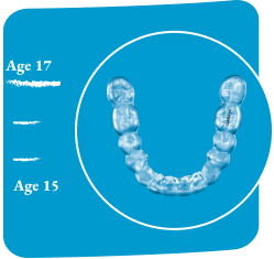 image-card-age-17-vivera-retainers