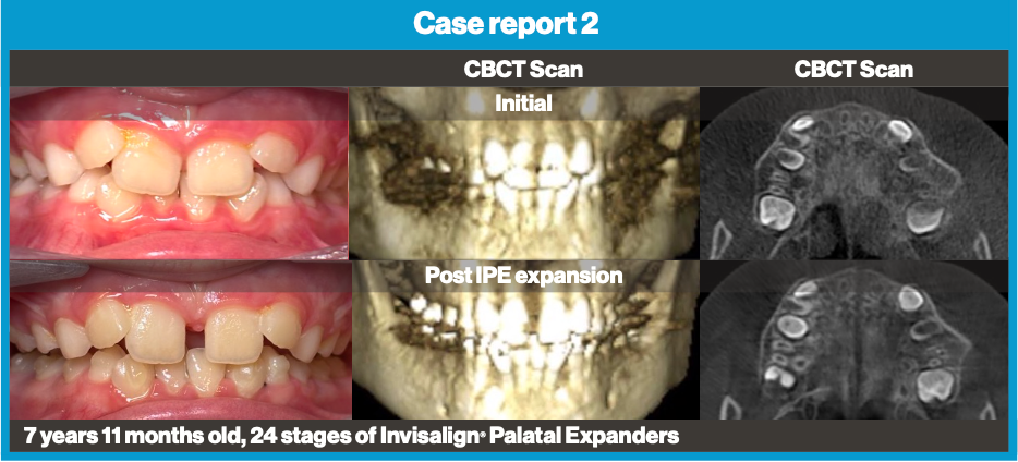 Courtesy of Dr. David R. Boschken