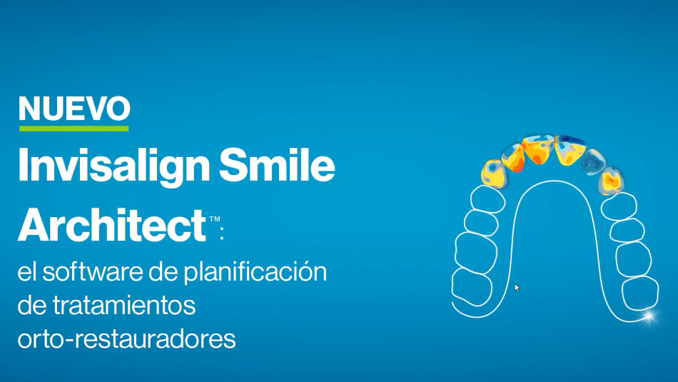 [ES] Invisalign Smile Architect > Combined ortho-restorative > Thumbnail