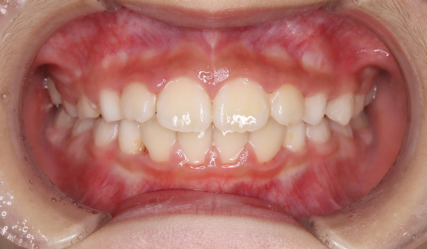after image