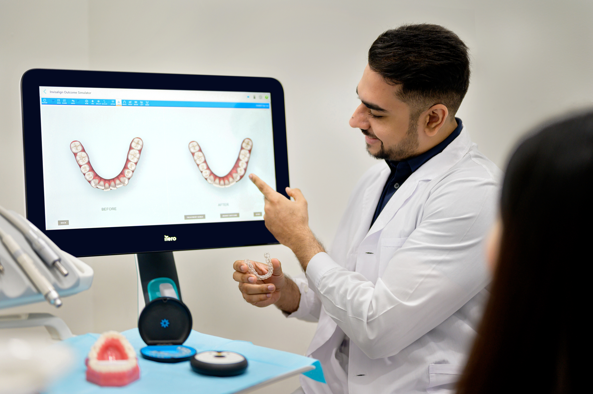 ALT99821 GP ROW iTero 14