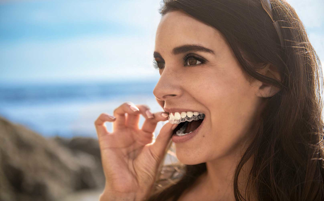 Le coût du traitement Invisalign | Combien coûte un traitement Invisalign