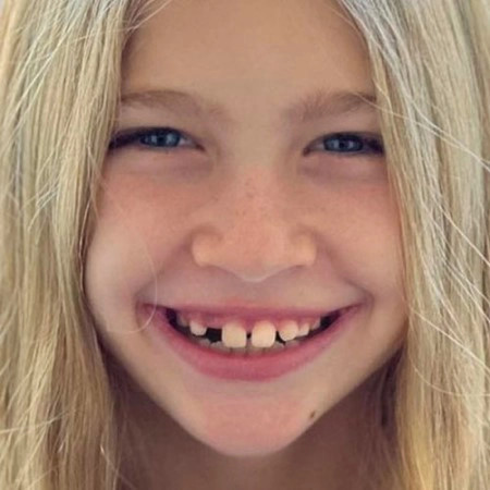 Little blonde girl's smile before her Invisalign® treatment