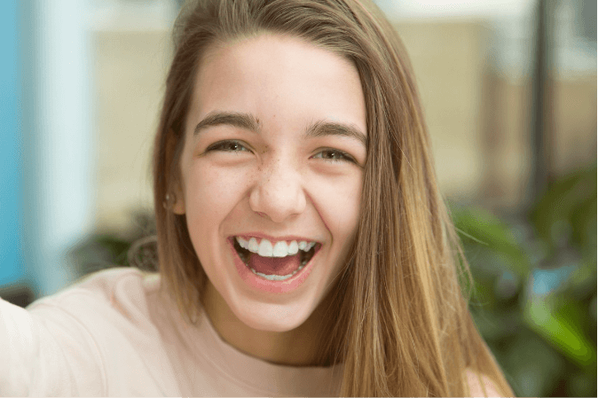 Invisalign teen smile