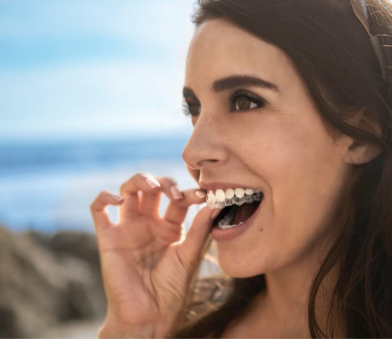 Donna che sta per indossare il suo allineatore trasparente - Invisalign Italia