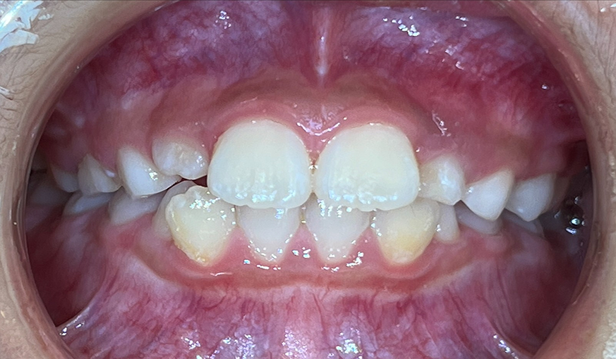 before image