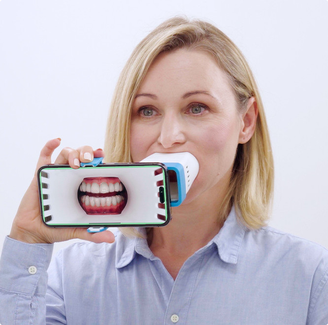 White woman taking a picture of her tooth using Invisalign Virtual Care AI tool