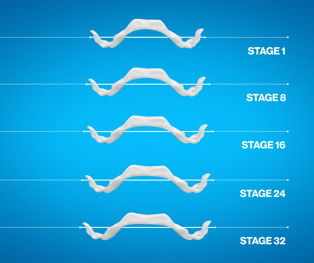 ipe product stages