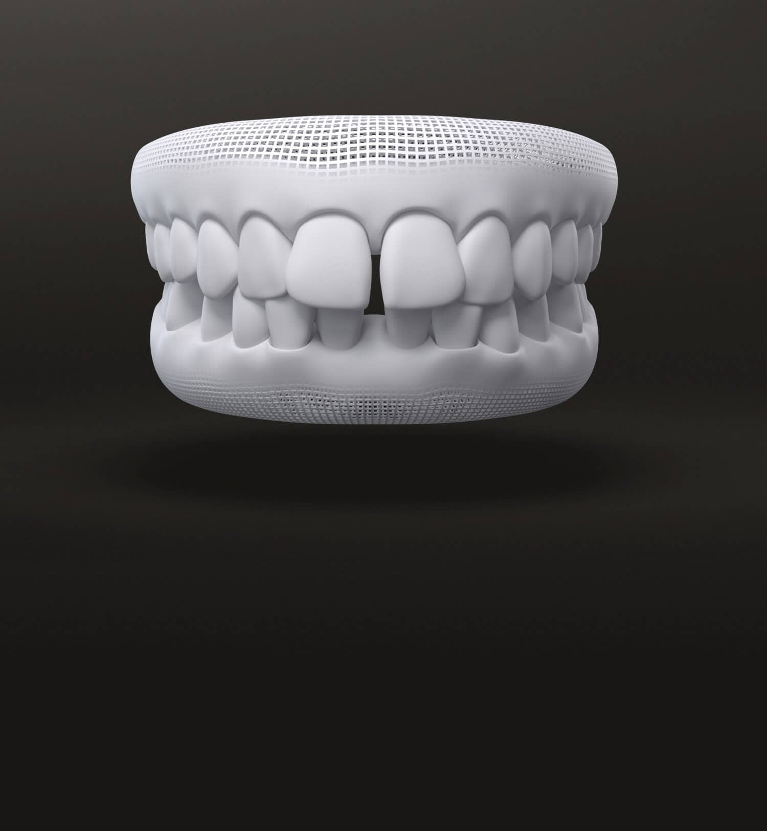 Spazi tra i denti modello 3D: casi trattabili con allineatori dentali Invisalign - Italia