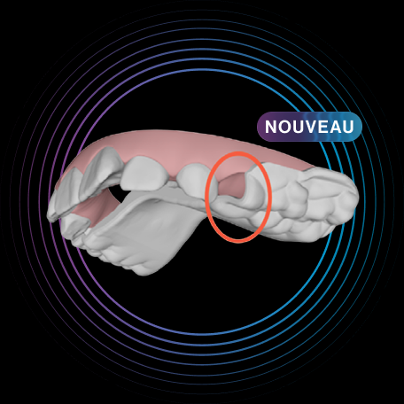 image-accordion-eruption-compensation-feature