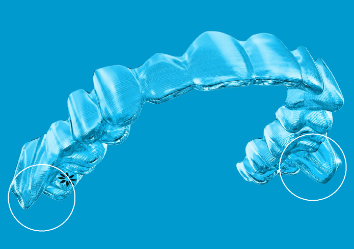 Mandibular advancement feature on Invisalign aligners