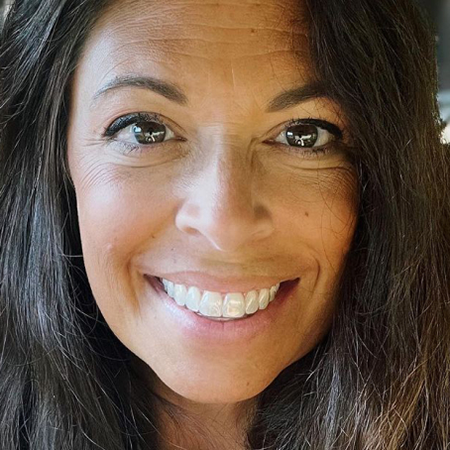 امرأة تبتسم بعد نجاح علاج Invisalign®
