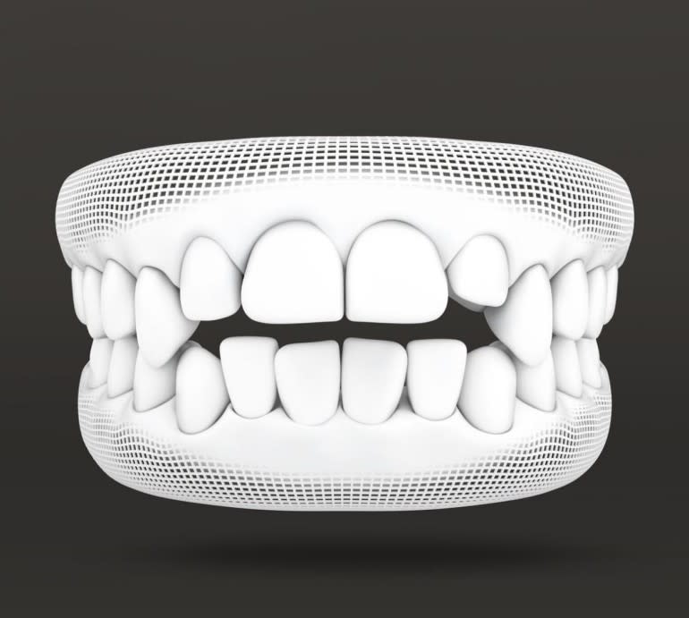 Treatable Cases > Carousel > Open bite > Image