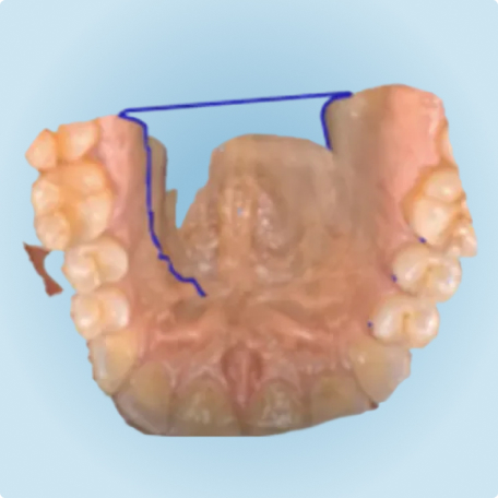 image-text-media-ipe-order-enhancements