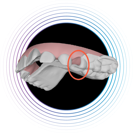 image-accordion-eruption-compensation-feature