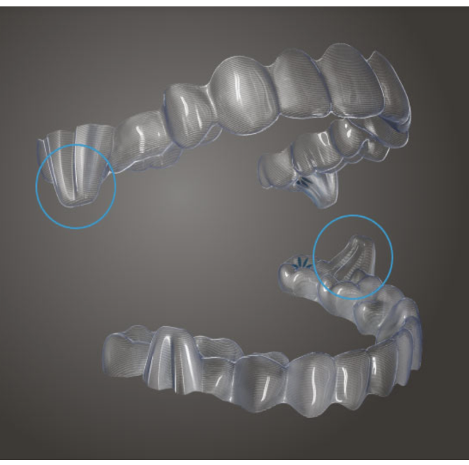 Invisalign mandibular advancement sample on aligners and black background