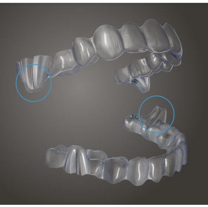 Invisalign mandibular advancement sample on aligners and black background