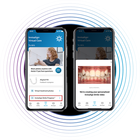 Innovation | Monitor | Invisalign Smile Progress™ Video